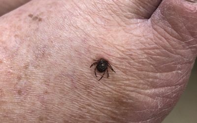 Watch Out For Ticks